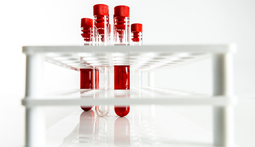 Liquid biopsy clinical trials